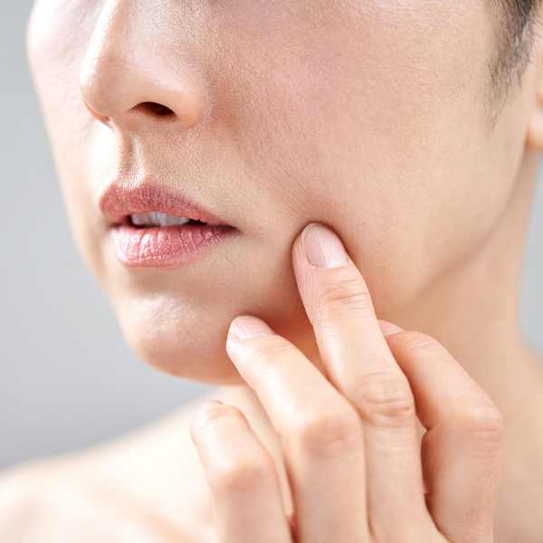 que es el relleno de líneas de marioneta en la clínica de medicina estética IME