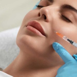 tipos de tratamientos con ácido hialurónico líneas de marioneta