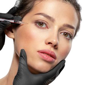 aplicación del radiesse como tratamiento de medicina estética