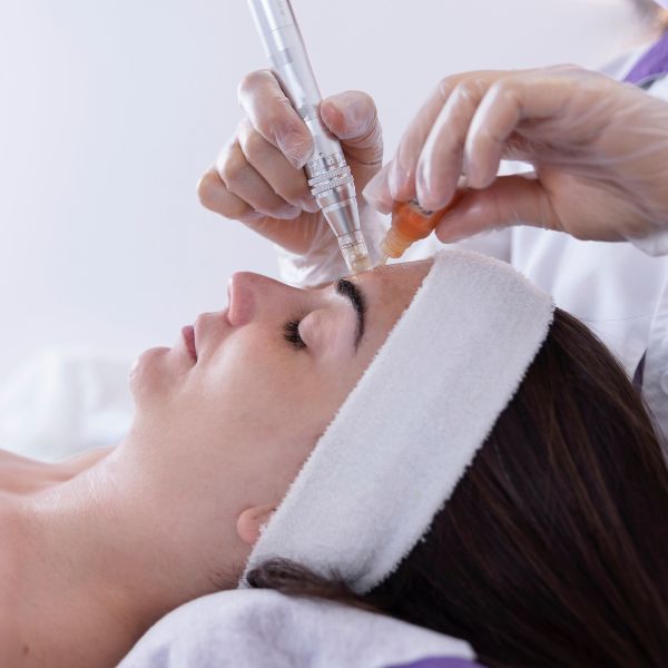 dermapen en la clínica de medicina estética en Madrid dermapen en la clínica de medicina estética en Madrid