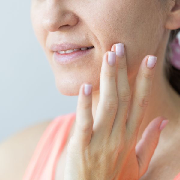 lineas de marioneta en Madrid. Tratamiento Clinica Medicina Estetica DA