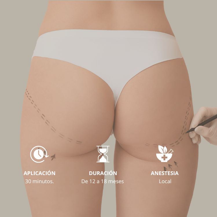 Aumento de Glúteos en la Clinica de Medicina Estetica en Madrid