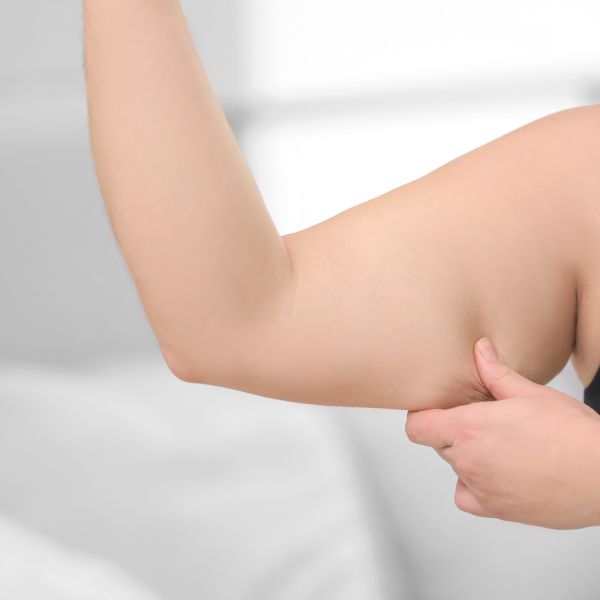 intralipoterapia brazos intralipoterapia brazos