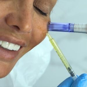 Vitaminas Faciales con Marta López en Clínica de Medicina Estética DA