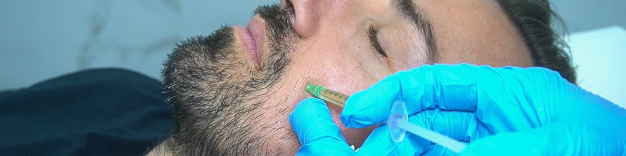 vitaminas faciales con Rafa Mora en Clínica de Medicina Estética DA