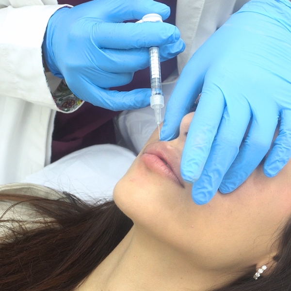 aumenta o hidrata los labios en la clinica de medicina estetica Madrid. Paciente de DA aumenta o hidrata los labios en la clinica de medicina estetica Madrid. Paciente de DA