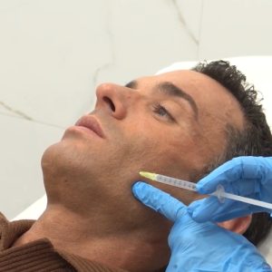 Enzimas Faciales con Antonio Rossi en Clinica DA