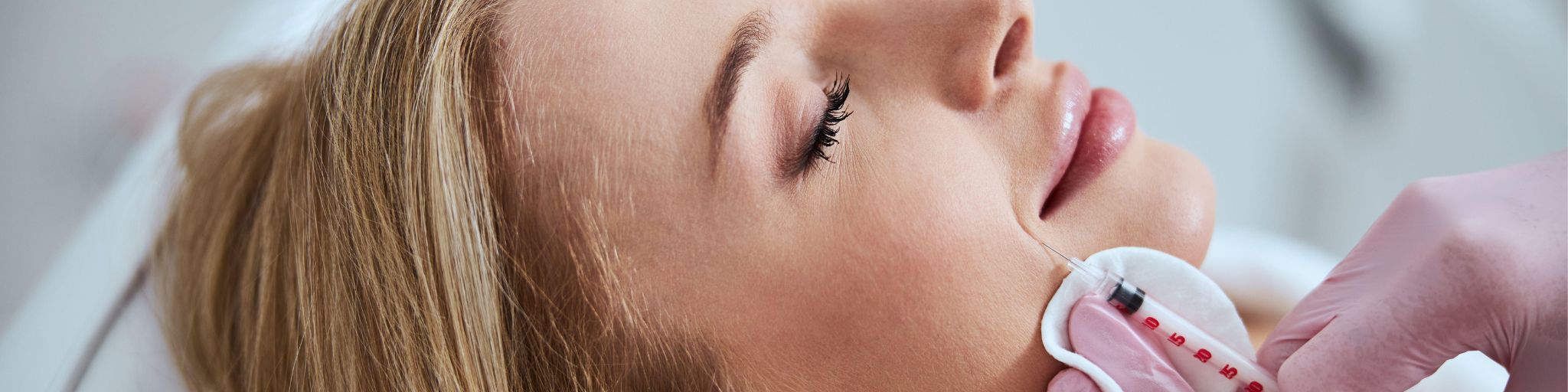 mejor clínica eliminar surco nasogeniano Madrid