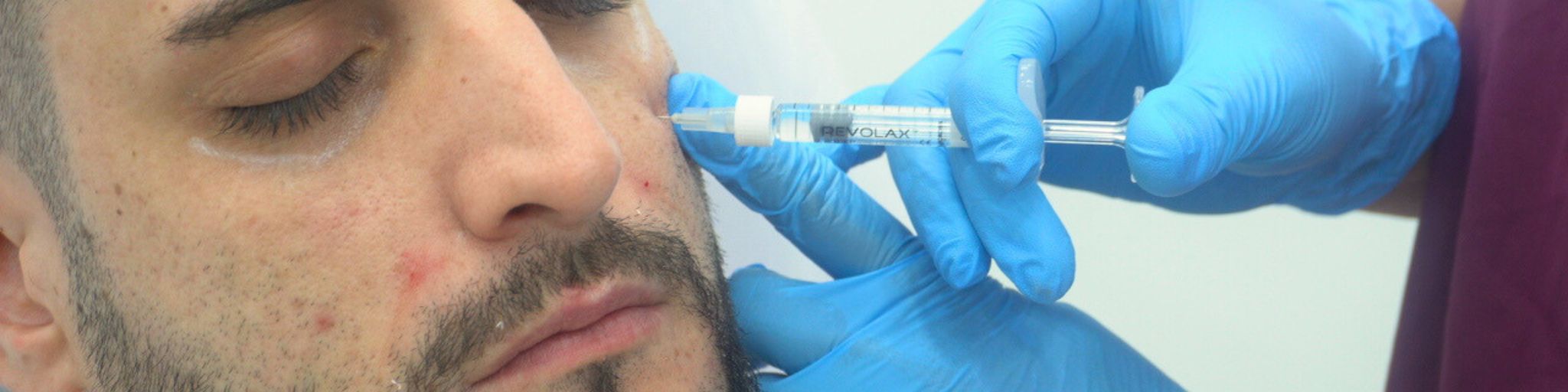 Mejor clínica eliminar ojeras Madrid en la Clínica de Medicina Estética DA